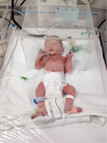 Preterm newborn in the hostipal baby beds