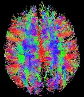 A Painted Brain that Resembles fMRI