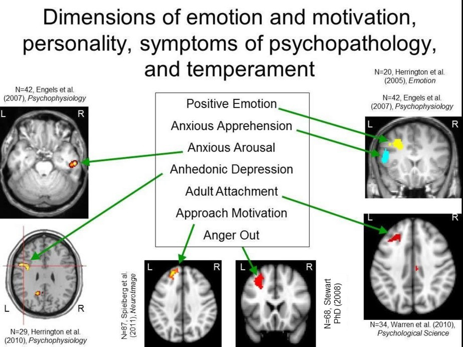 Slide showing where different emotional functions are processed