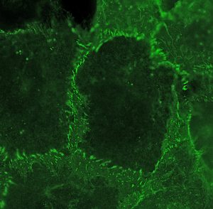 Super resolution image of cadherin at cell-cell junctions