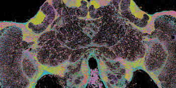 Honey Bee Brain Slice