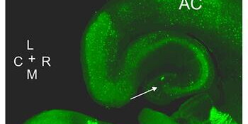 thalamic reticular nucleus