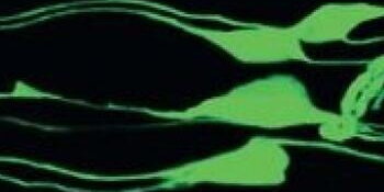 green nemotide