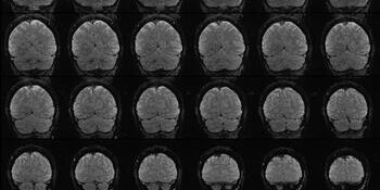 All different kinds of brains