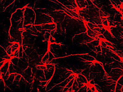 neural network