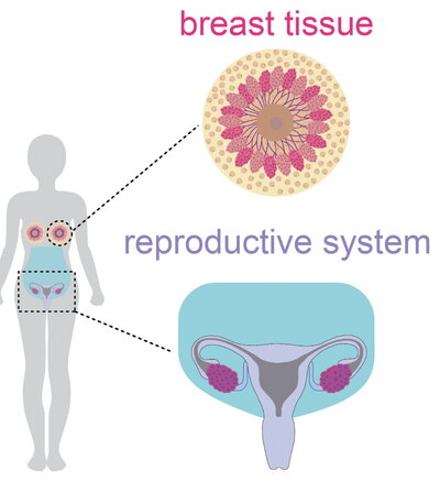 Breast Cancer