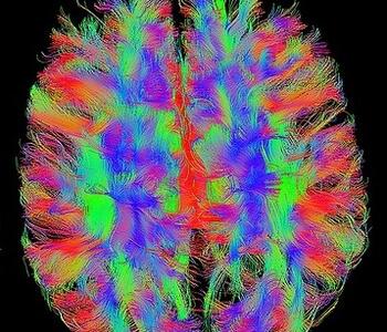 Paint fMRI Brain