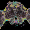 Honey Bee Brain Slice
